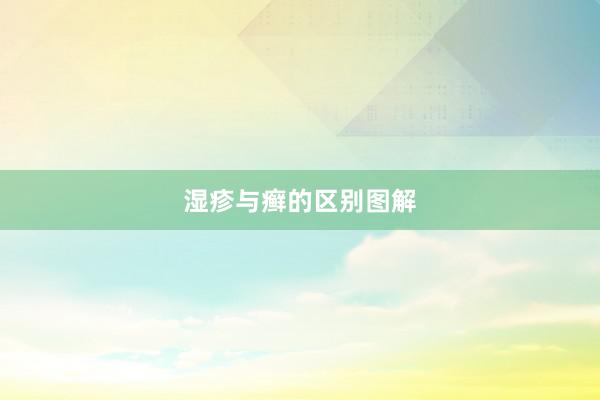 湿疹与癣的区别图解